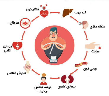 سبک زندگی غلط عوارض چاقی